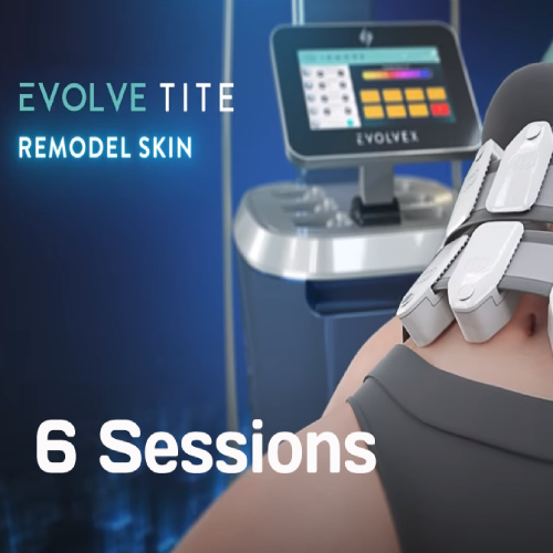 Evolve-Tite (6 sessions)