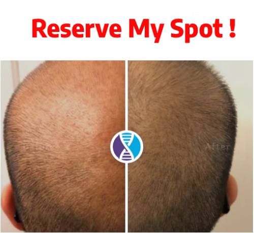 Hair Loss Restoration Special - Reservation